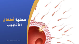 عملية أطفال الأنابيب في تركيا