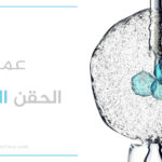 عملية الحقن المجهري في تركيا