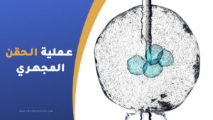 عملية الحقن المجهري في تركيا