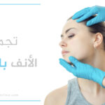 تجميل الأنف بالخيوط