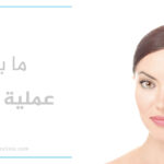 بعد عملية الليزك