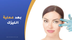 بعد عملية الليزك