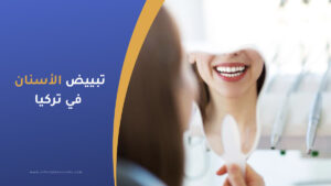 تبييض الأسنان في تركيا