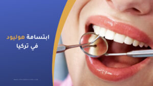 ابتسامة هوليود في تركيا الاسعار