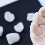 الفرق بين الفينير والزيركون وايهما أفضل