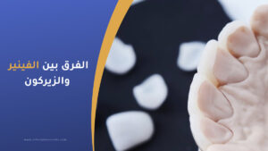 الفرق بين الفينير والزيركون وايهما أفضل