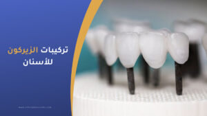تركيبات الزيركون للأسنان