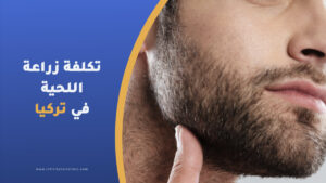 تكلفة زراعة شعر الذقن في تركيا