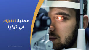 عملية الليزك للعيون في تركيا
