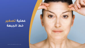 عملية تصغير خط الجبهة