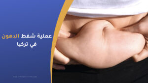 عملية شفط الدهون في تركيا الاسعار